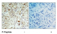 AP02419PU-S - Retinoblastoma-associated protein / RB1