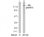 AP02419PU-S - Retinoblastoma-associated protein / RB1