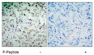AP02420PU-S - Retinoblastoma-associated protein / RB1