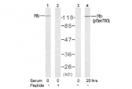 AP02420PU-S - Retinoblastoma-associated protein / RB1