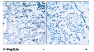 AP02422PU-S - CDK1