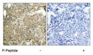AP02426PU-S - Cofilin-1