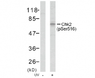 AP02432PU-N - CHK2