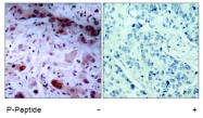 AP02433PU-S - Tyrosine-protein kinase JAK1