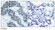 AP02435PU-S - Tyrosine-protein kinase JAK2
