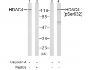 AP02464PU-S - HDAC4