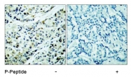 AP02465PU-S - HDAC5