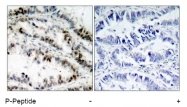 AP02467PU-N - SMC1A / SMC1