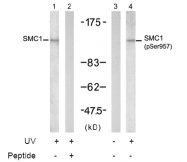 AP02467PU-N - SMC1A / SMC1