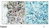 AP02649PU-S - Tyrosine-protein kinase JAK1