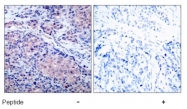 AP02651PU-N - NFKBIA / IKBA