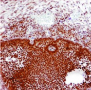 SM1682X - Estrogen receptor beta