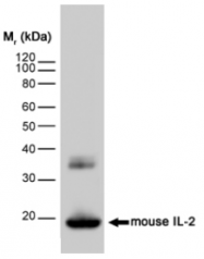SM1698P - Interleukin-2 / IL2
