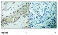 AP02669PU-S - HDAC5