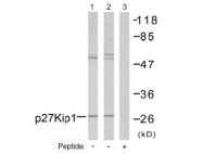 AP02674PU-S - CDKN1B / KIP1
