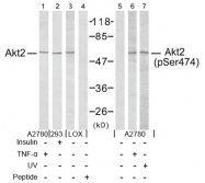 AP02678PU-S - AKT2 / PKB beta
