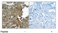 AP02685PU-S - Cofilin-1