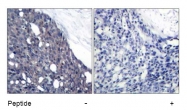 AP02694PU-N - NFKBIA / IKBA
