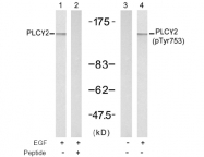 AP02700PU-N - PLCG2