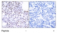 AP02703PU-N - SMC1A / SMC1
