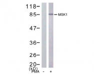 AP02710PU-S - RPS6KA5 / MSK1