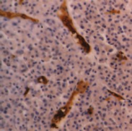 SM1473P - CD235a / GYPA