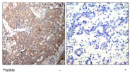 AP02789PU-S - Cytokeratin 18