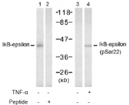 AP02784PU-S - NFKBIE / IKBE