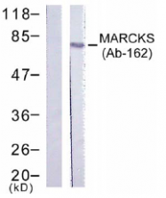 AP02758PU-S - MARCKS