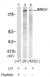 AP02739PU-S - BRCA1 / RNF53