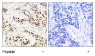 AP02740PU-S - CDK1