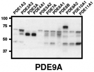 AP00660SU-N - PDE9A