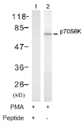 AP02748PU-S - RPS6KB1 / STK14A