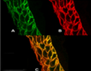 SM5057P - ATP2B4 / PMCA4