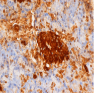 BM508 - Insulin
