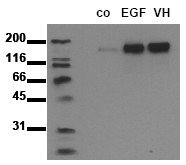 AM00037PU-N - EGFR / ERBB1