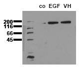 AM00039PU-N - EGFR / ERBB1