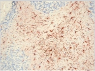 BP4003 - CD88 / C5R1