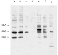 BP4001 - ITM2B