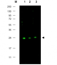 R1007 - CDKN1B / KIP1