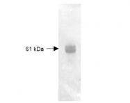 R1072 - Carboxypeptidase Y