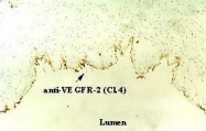 DM3523P - CD309 / VEGFR-2 / Flk-1