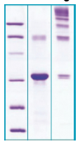 PA501X - Adiponectin