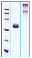 PA500X - Adiponectin