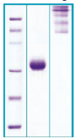 PA502X - Adiponectin