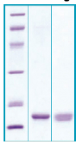 PA503X - Agouti-related protein / AGRP