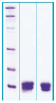 PA506X - Cystatin-C
