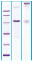 PA510X - CD340 / ERBB2 / HER2