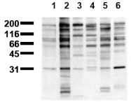 AM00124BT-N - Phosphotyrosine
