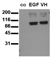 AM00148PU-N - STAT3